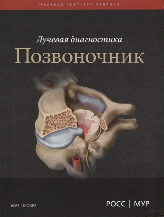 

Лучевая диагностика Позвоночник
