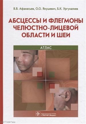 

Абсцессы и флегмоны челюстно-лицевой области и шеи Атлас