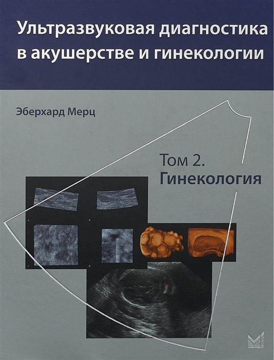 

Ультразвуковая диагностика в акушерстве и гинекологии Том 2 Гинекология