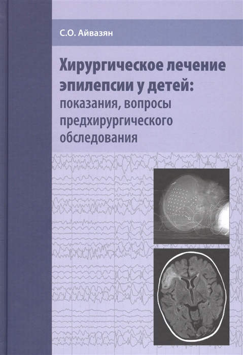 Айвазян С. - Хирургическое лечение эпилепсии у детей показания вопросы предхирургического обследования