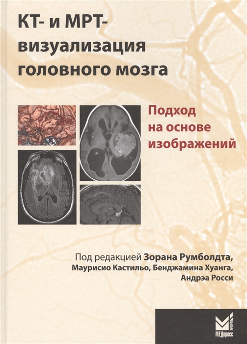 

КТ- и МРТ- визуализация головного мозга Подход на основе изображдений