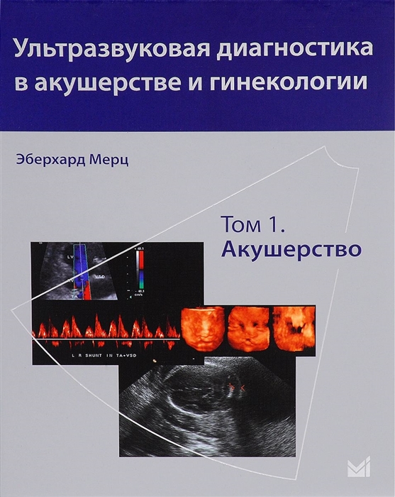 

Ультразвуковая диагностика в акушерстве и гинекологии Том 1 Акушерство