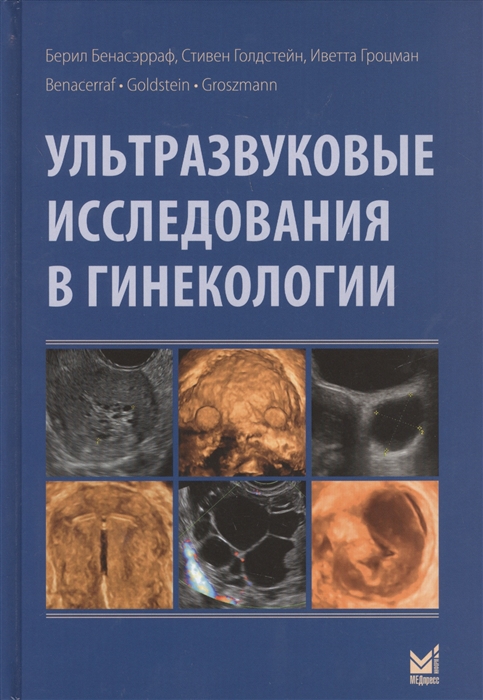 Бенасэрраф Б., Голдстейн С., Гроцман И. - Ультразвуковые исследования в гинекологии