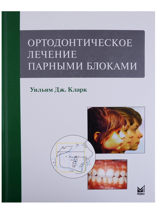 

Ортодонтическое лечение парными блоками