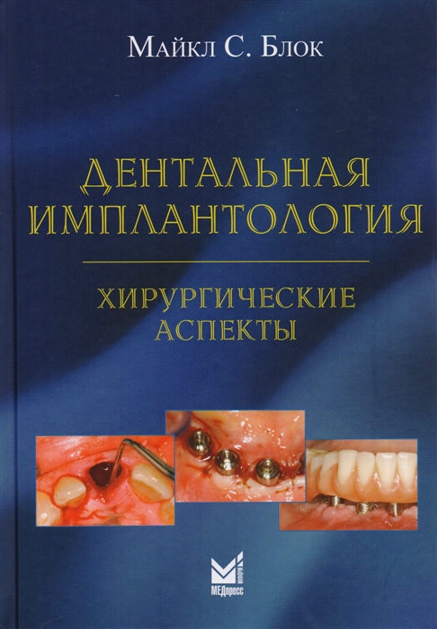 

Дентальная имплантология хирургические аспекты
