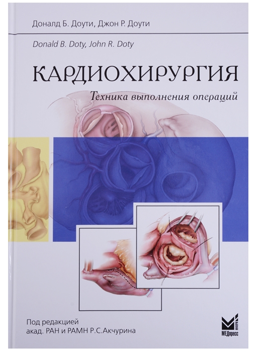 

Кардиохирургия Техника выполнения операций