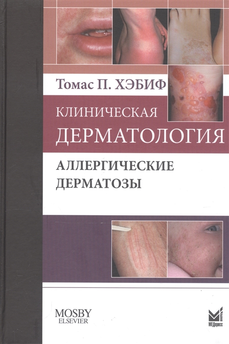 

Клиническая дерматология Аллергические дерматозы