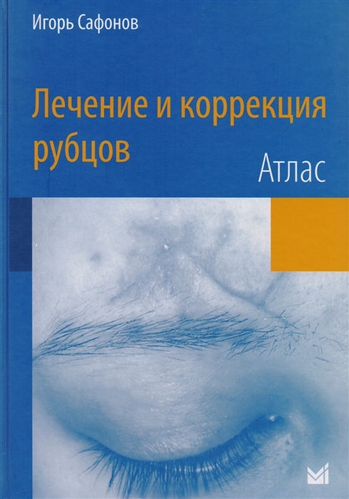

Лечение и коррекция рубцов Атлас