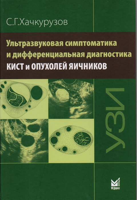 

Ультразвуковая симптоматика и дифференциальная диагностика кист и опухолей яичников
