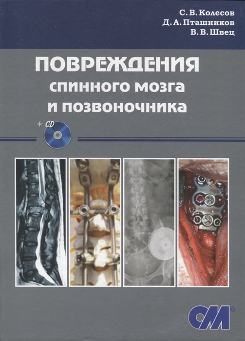 

Повреждения спинного мозга и позвоночника CD