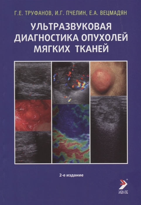 

Ультразвуковая диагностика опухолей мягких тканей