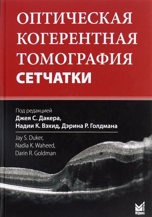 

Оптическая когерентная томография сетчатки