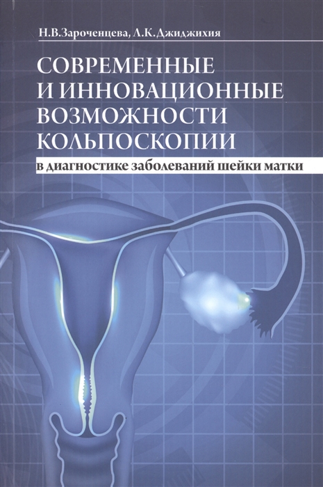 Современные и инновационные возможности кольпоскопии в диагностике заболеваний шейки матки