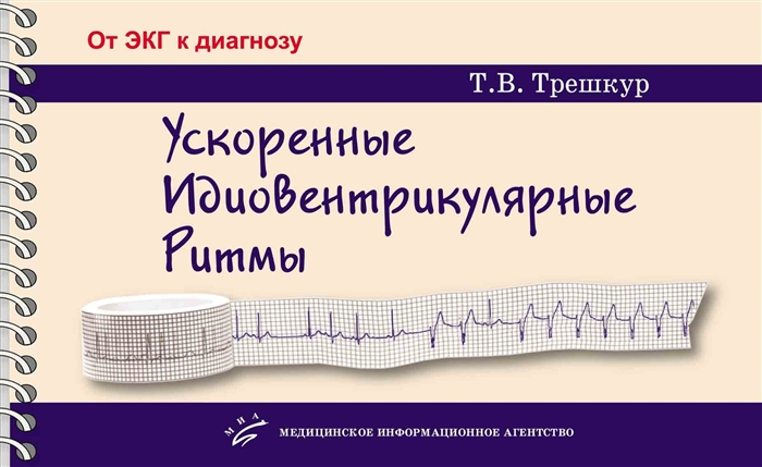 

Ускоренные идиовентрикулярные ритмы