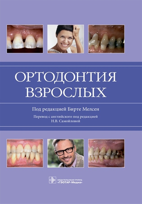 

Ортодонтия взрослых