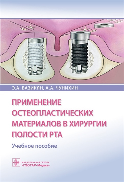 Базикян Э., Чунихин А. - Применение остеопластических материалов в хирургии полости рта Учебное пособие