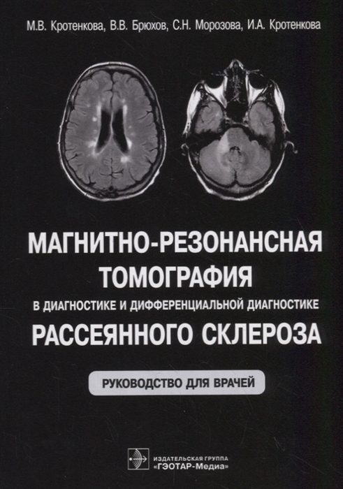 Кротенкова М., Брюхов В., Морозова С. - Магнитно-резонансная томография в диагностике и дифференциальной диагностике рассеянного склероза Руководство для врачей