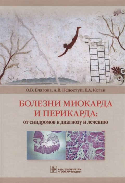 Благова О., Недоступ А., Коган Е., Заклязьминская Е. - Болезни миокарда и перикарда от синдромов к диагнозу и лечению