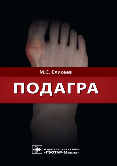 

Подагра