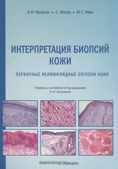 

Интерпретация биопсий кожи Первичные нелимфоидные опухоли кожи