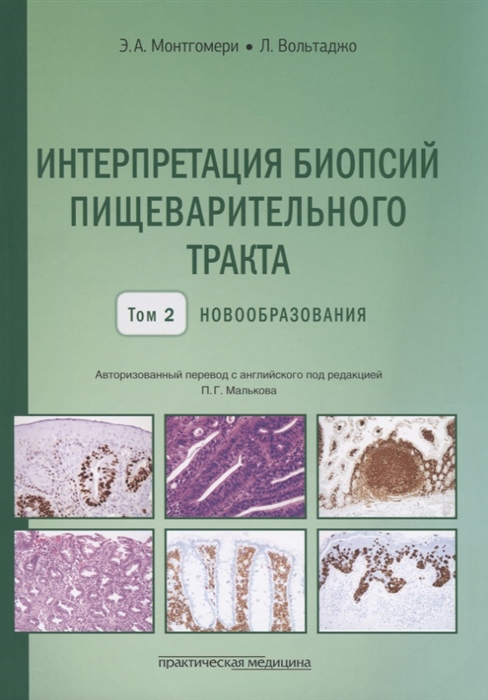 

Интерпретация биопсий пищеварительного тракта Том 2 Новообразования