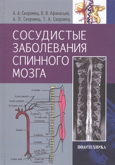 Скоромец А., Афанасьев В., Скоромец А., Скоромец Т. - Сосудистые заболевания спинного мозга Руководство для врачей