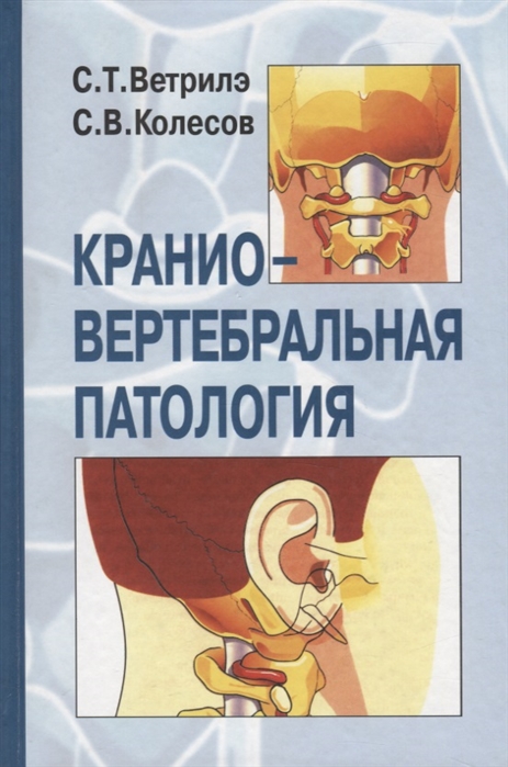 

Краниовертебральная патология