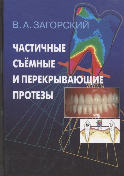 Загорский В. - Частичные съемные и перекрывающие протезы Морфология и ультраструктура