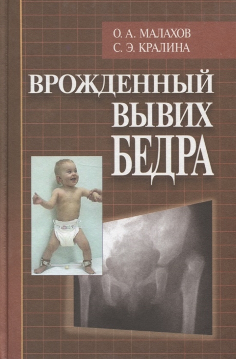 Малахов О., Кралина С. - Врожденный вывих бедра клиническая картина диагностика консервативное лечение