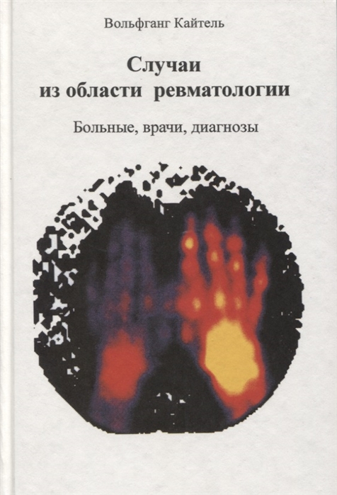 

Случаи из области ревматологии Больные врачи диагнозы