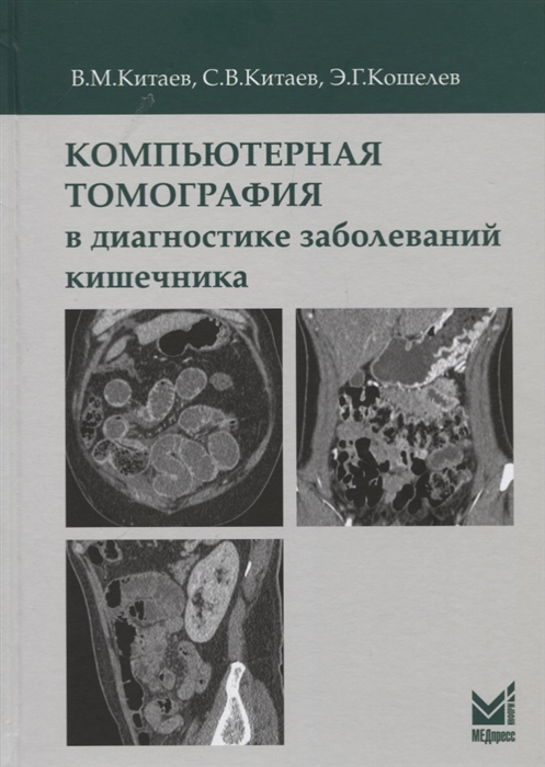 Китаев В., Китаев С., Кошелев Э. - Компьютерная томография в диагностике заболеваний кишечника