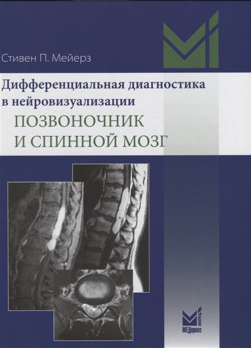 

Дифференциальная диагностика в нейровизуализации Позвоночник и спинной мозг