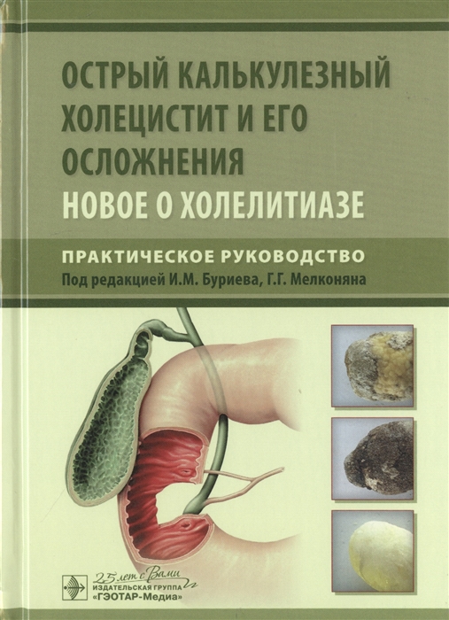 Буриев И., Веденина И., Мелконян Г. - Острый калькулезный холецистит и его осложнения Новое о холелитиазе Практическое руководство