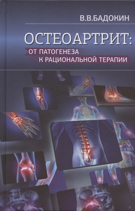 

Остеоартрит от патогенеза к рациональной терапии