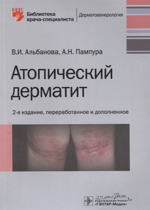 

Атопический дерматит