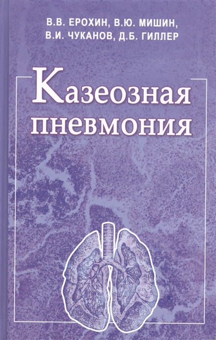 Ерохин В., Мишин В., Чуканов В., Гиллер Д. - Казеозная пневмония Руководство для врачей