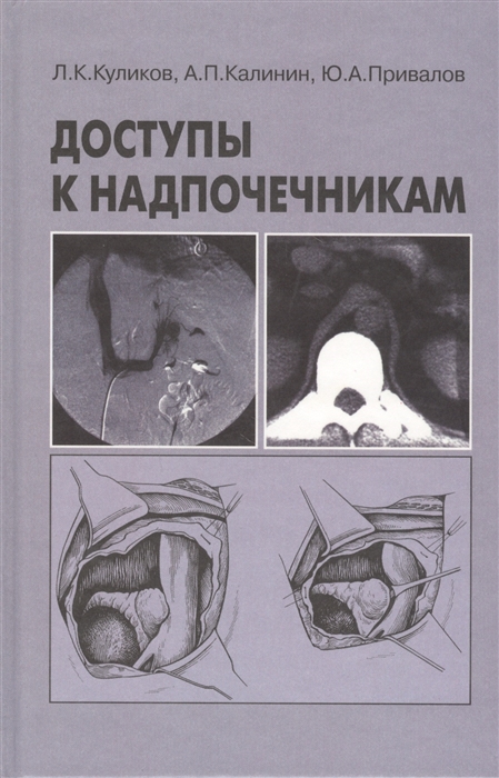 Куликов Л., Калинин А., Привалов Ю. - Доступы к надпочечникам Руководство для врачей