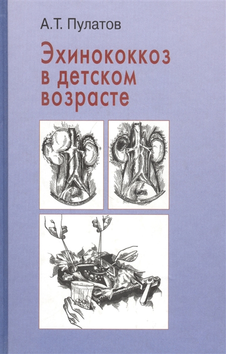 Пулатов А. - Эхинококкоз в детском возрасте