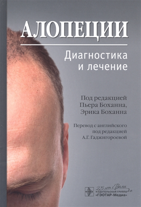 

Алопеции Диагностика и лечение