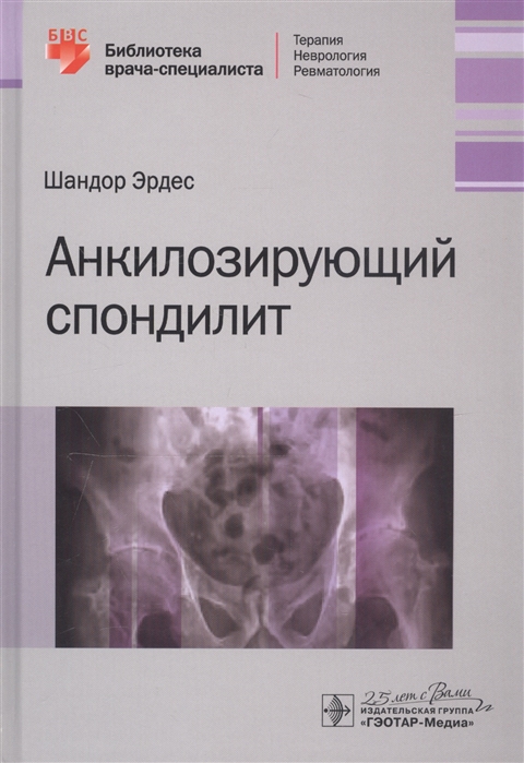 

Анкилозирующий спондилит