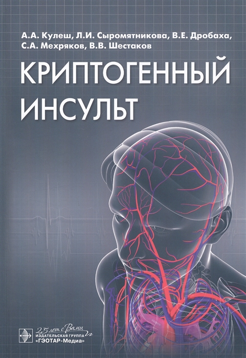 

Криптогенный инсульт Руководство