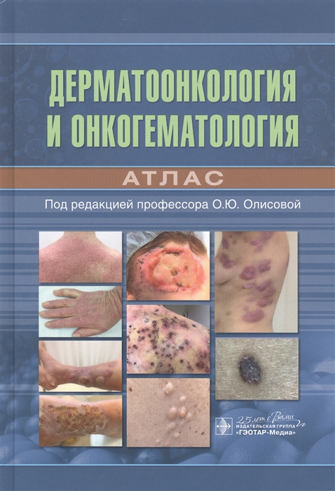 

Дерматоонкология и онкогематология Атлас