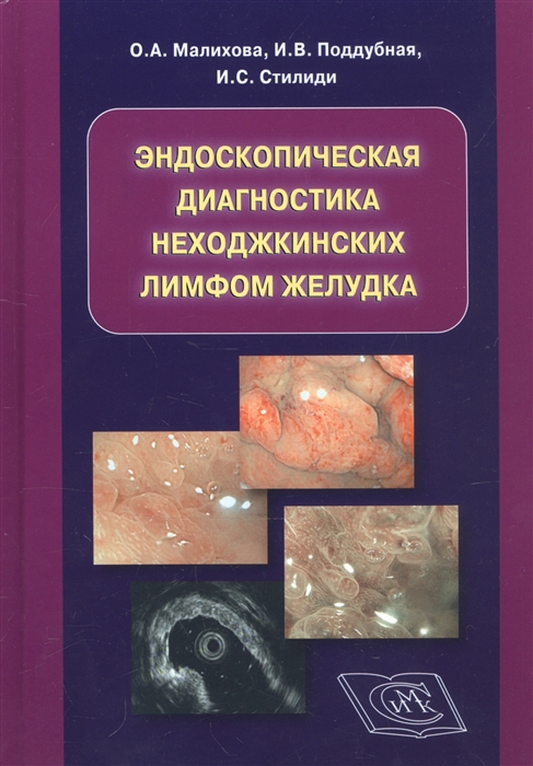 

Эндоскопическая диагностика неходжкинских лимфом желудка