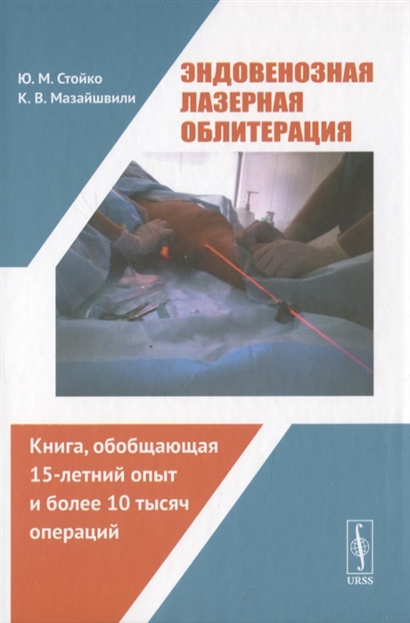 

Эндовенозная лазерная облитерация