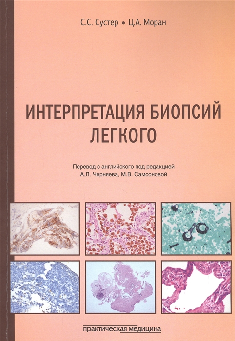 

Интерпретация биопсий легкого