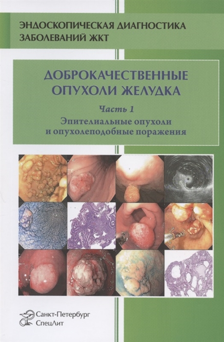 Кузин М., Добронец В., Шкалова Л., Радовский В. - Доброкачественные опухоли желудка Эпителиальные опухоли и опухолеподобные поражения Часть 1 Учебно-методическое пособие