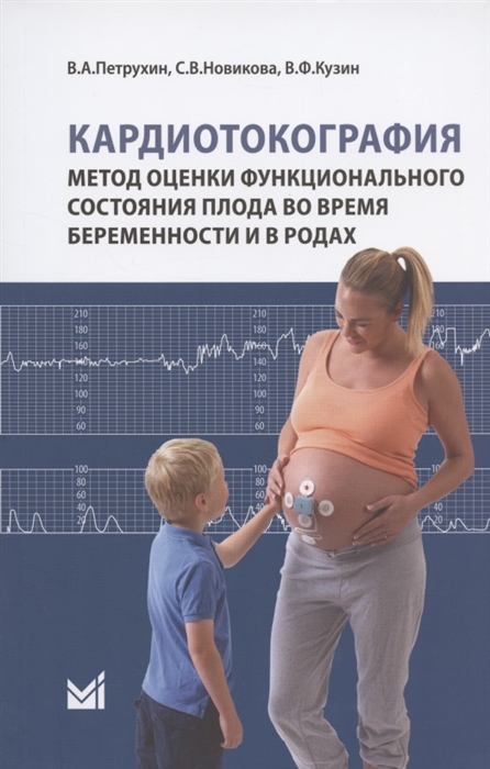 Кардиотокография Метод оценки функционального состояния плода во время беременности и в родах Учебное пособие