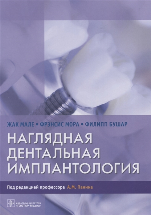 

Наглядная дентальная имплантология