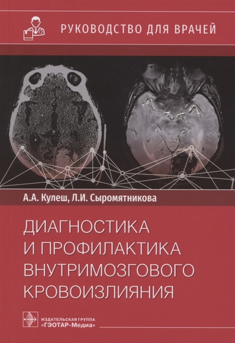 

Диагностика и профилактика внутримозгового кровоизлияния Руководство для врачей