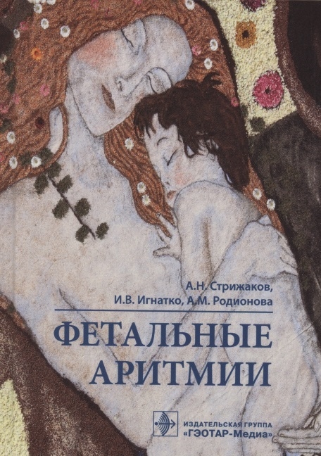 

Фетальные аритмии